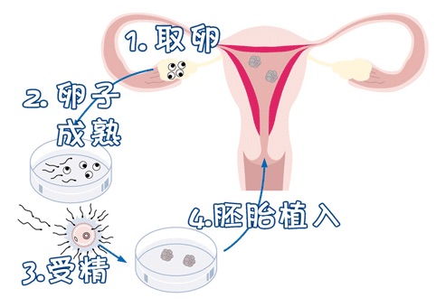关于供卵代怀公司